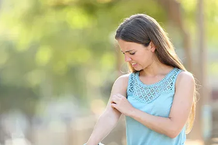 itching mosquito